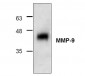 MMP-9 Antibody